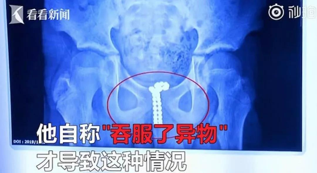 熊孩子玩射箭却意外杀死小女孩,熊孩子玩手雷被军人救了