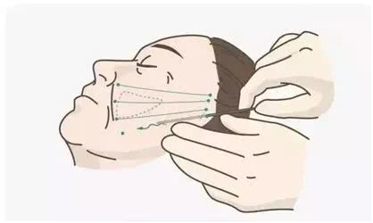 微整的真实效果,微整蜕变过程