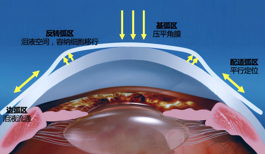 小晶体，大视界这家企业为无数患者带来光明