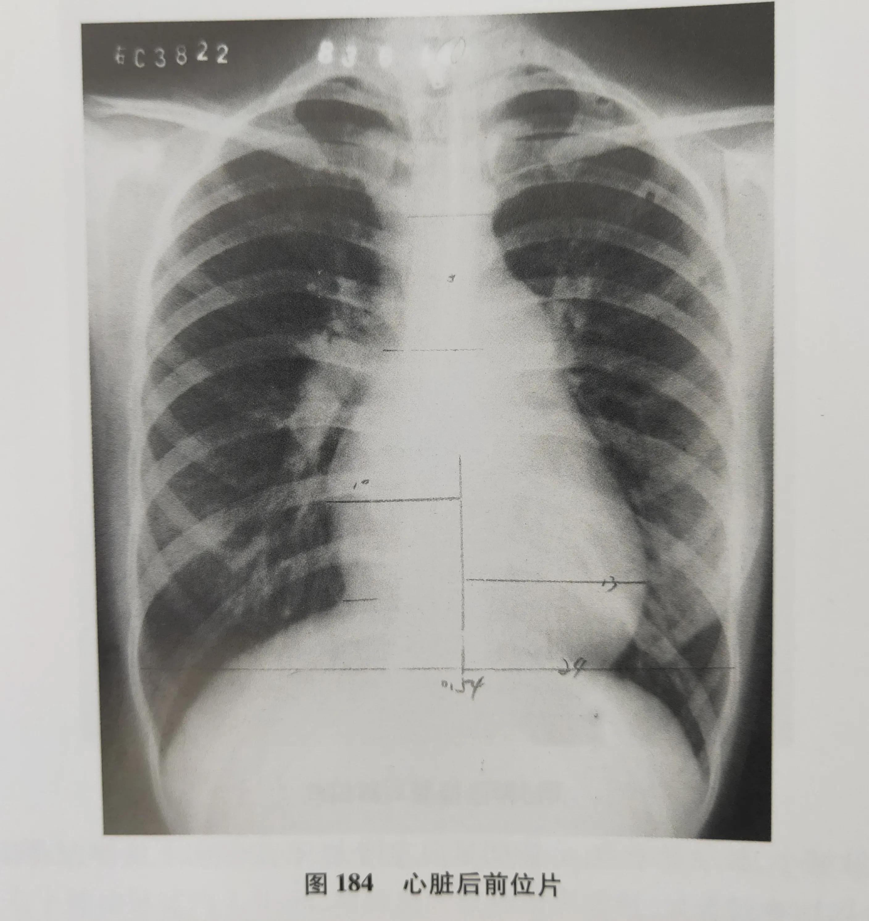 学习《X线读片指南》第一节X线成像的基本原理