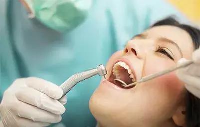 Helen齿科中心——超声波洁牙