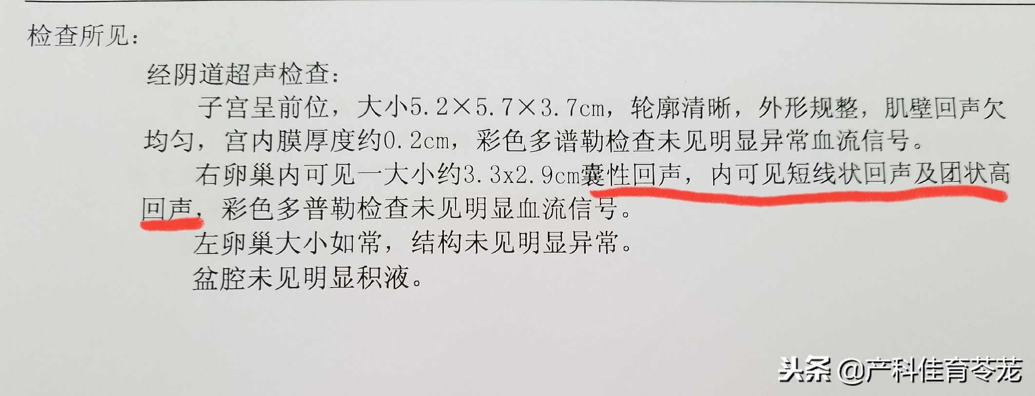 做b超能看见卵巢吗,妇科b超结果显示卵巢什么意思