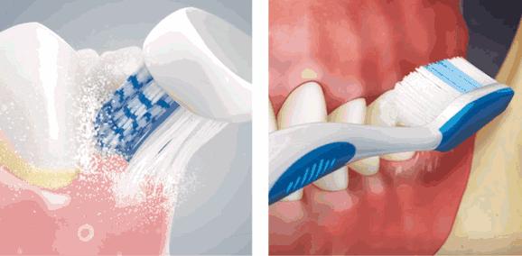 牙齿变黑变黄用什么清洗,牙齿发黄有牙垢用什么牙膏