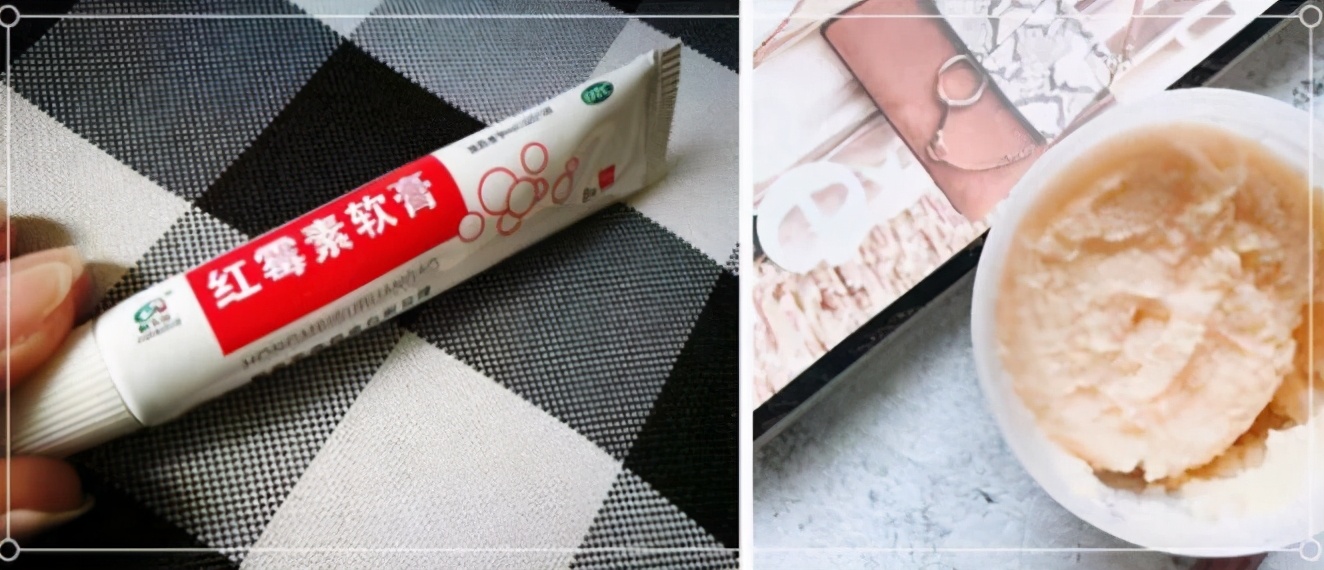 脸上的脂肪粒怎么才能消除视频,脸上有脂肪粒用什么方法最好