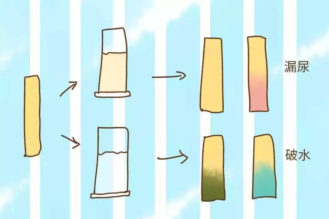 破水了准备去医院,破水了要准备什么