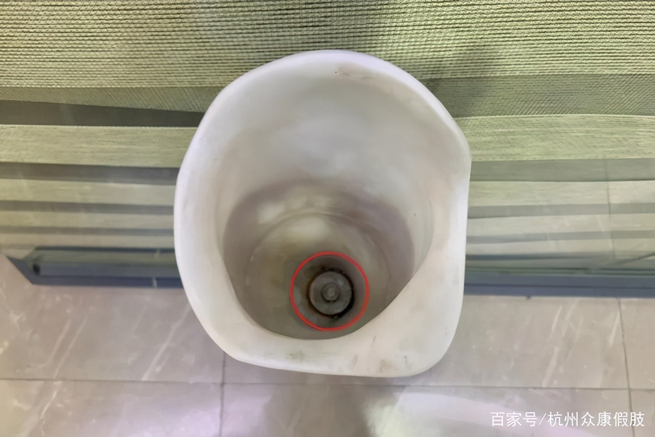 假肢接收腔选用材料详解,云南仿生假肢接收腔