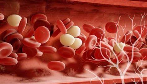 动脉斑块能用中医中药消除吗,动脉斑块可以吃药消除吗