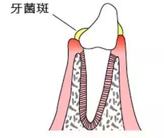 一口黄牙毁了一张脸视频,一口黄牙影响颜值