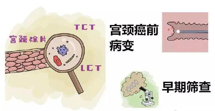 宫颈癌筛查pcr结果怎样看,tcthpv结果报告单怎么看