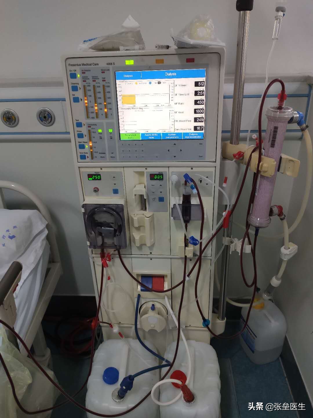 得了尿毒症如何面对生死,尿毒症都用什么方法透析