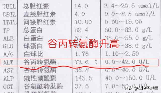 体检中谷丙转氨酶偏高是怎么回事,体检发现谷丙转氨酶升高什么原因