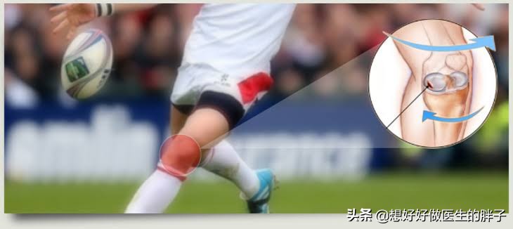 为什么足球运动员不会半月板受伤,半月板伤病对足球运动员影响大吗