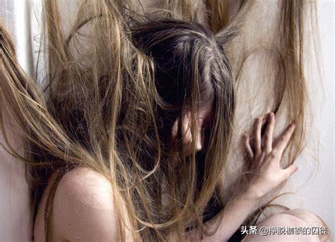 对有毛的动物恐惧心理,对任何动物都害怕