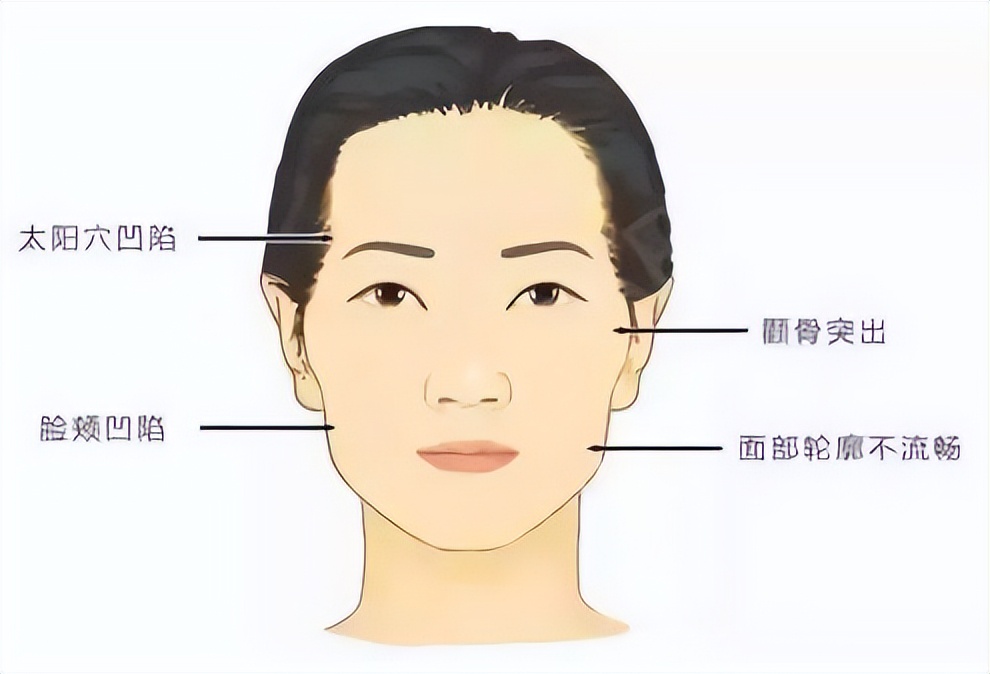 上海九院韦敏轮廓做得好吗,九院韦敏磨骨好吗