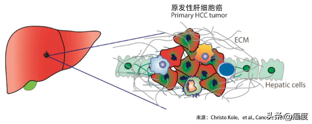 癌症保守治疗和激进治疗,癌症最佳细胞疗法