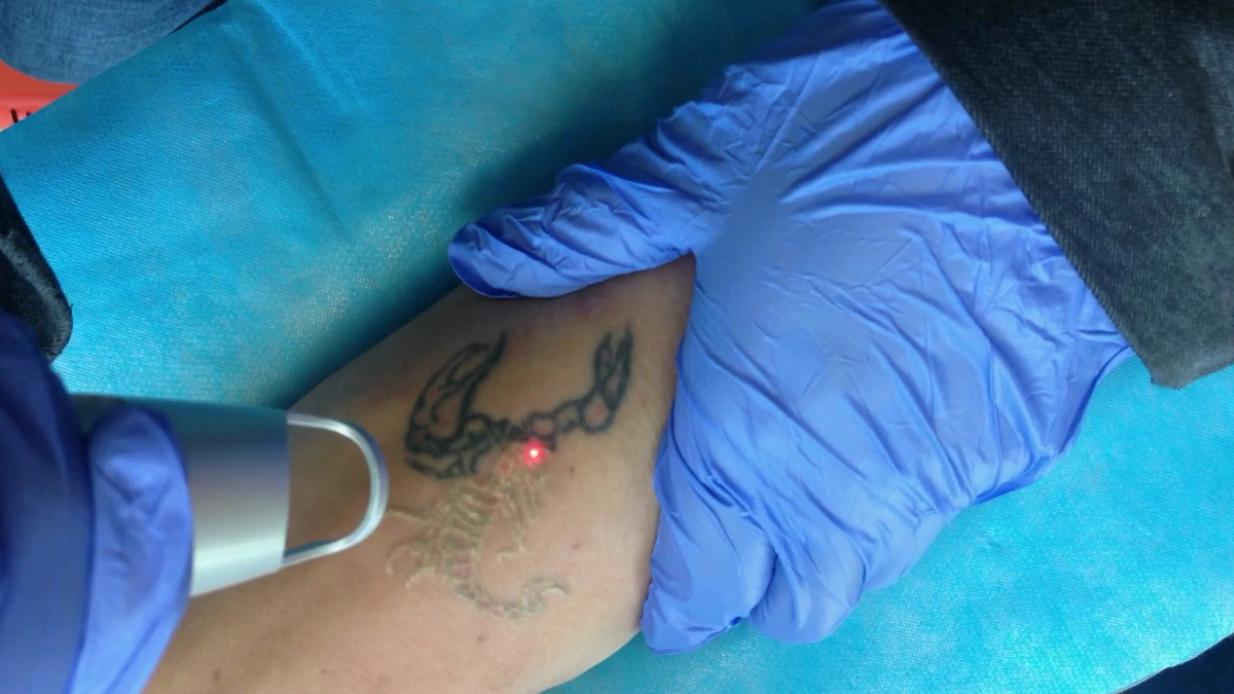 去除纹身过程有多痛,纹身的真相