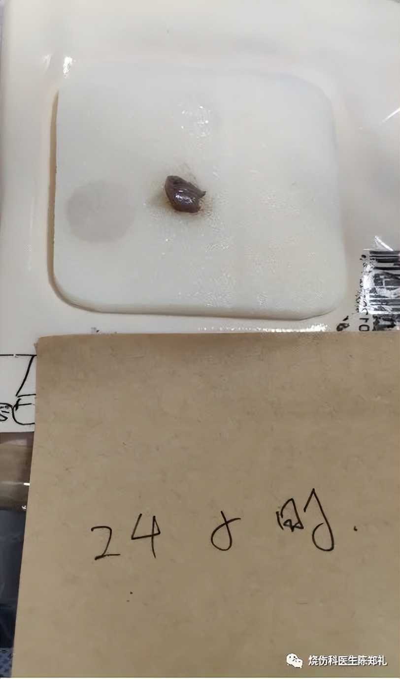 创面外用药物及敷料的使用策略及理论依据