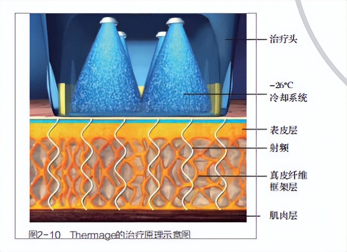 做热玛吉紧肤除皱多少钱,热玛吉紧肤祛皱需要多少钱