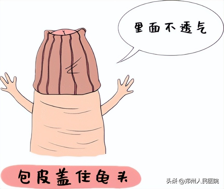 青春期男孩“丁丁”上长黄豆？医生：长期刺激可致癌！