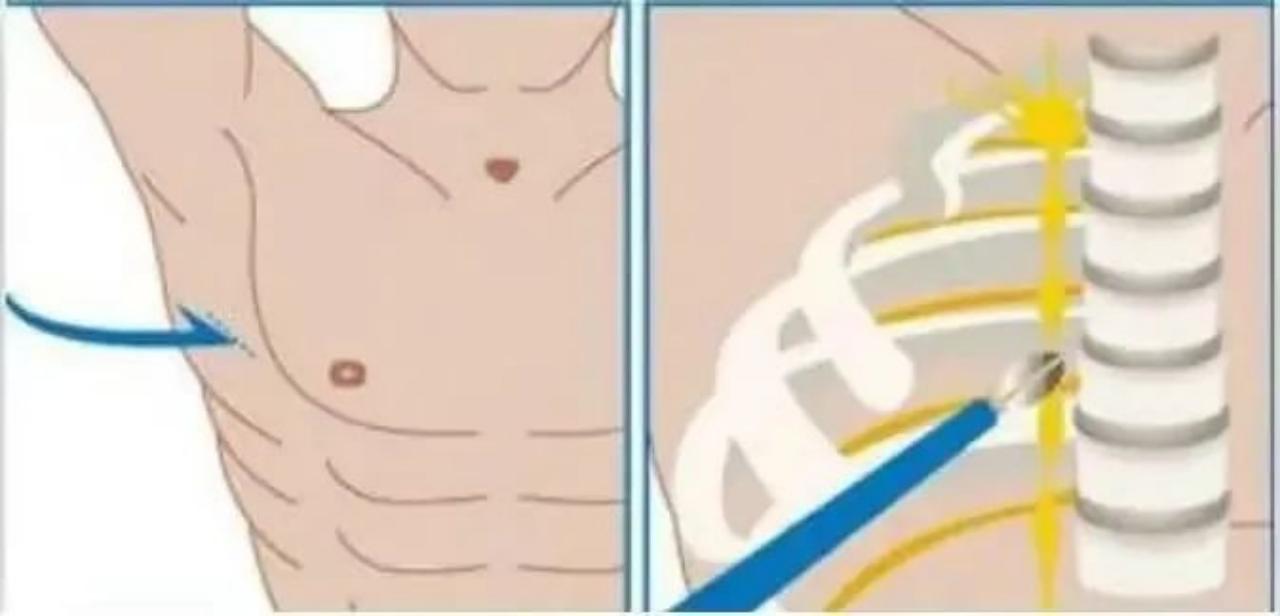 手心长期出汗是什么原因怎样治疗,手心出汗多的原因及解决方法