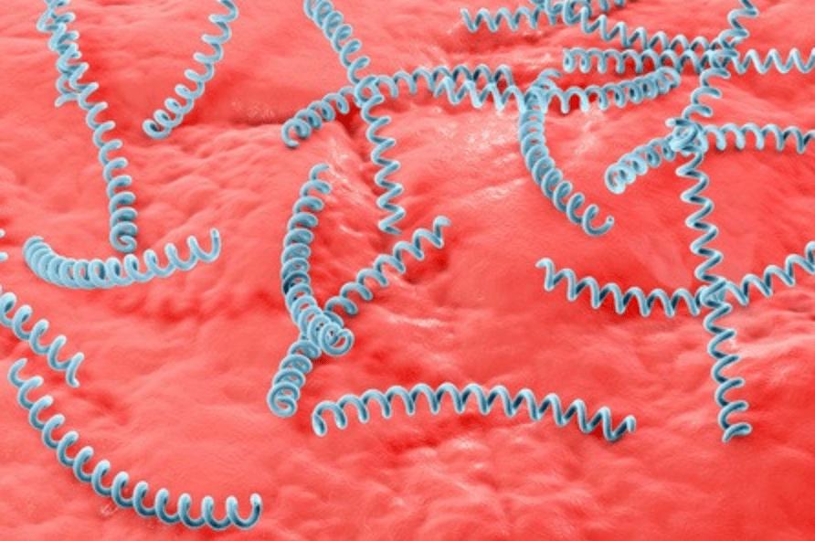 得了梅毒有什么症状？身上会痒吗？梅毒能治愈吗？早了解早受益