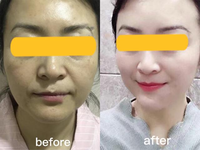 为什么随着年龄脸越来越大,为什么随着年龄的增长脸越来越宽