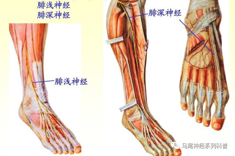 腓总神经卡压综合征点穴按摩,腓总神经卡压综合征