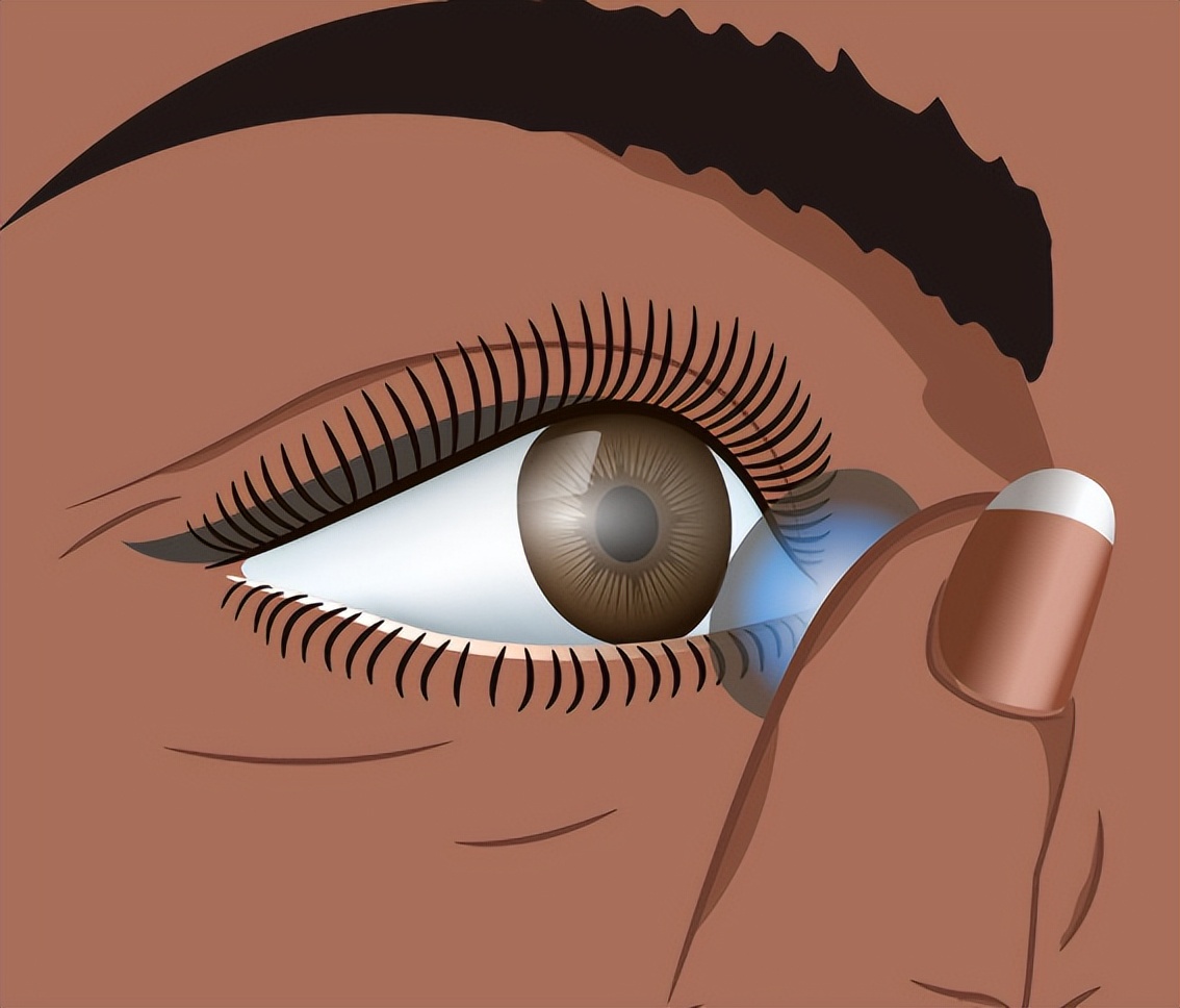 高分子水凝胶的应用,胶原蛋白水凝胶复合材料