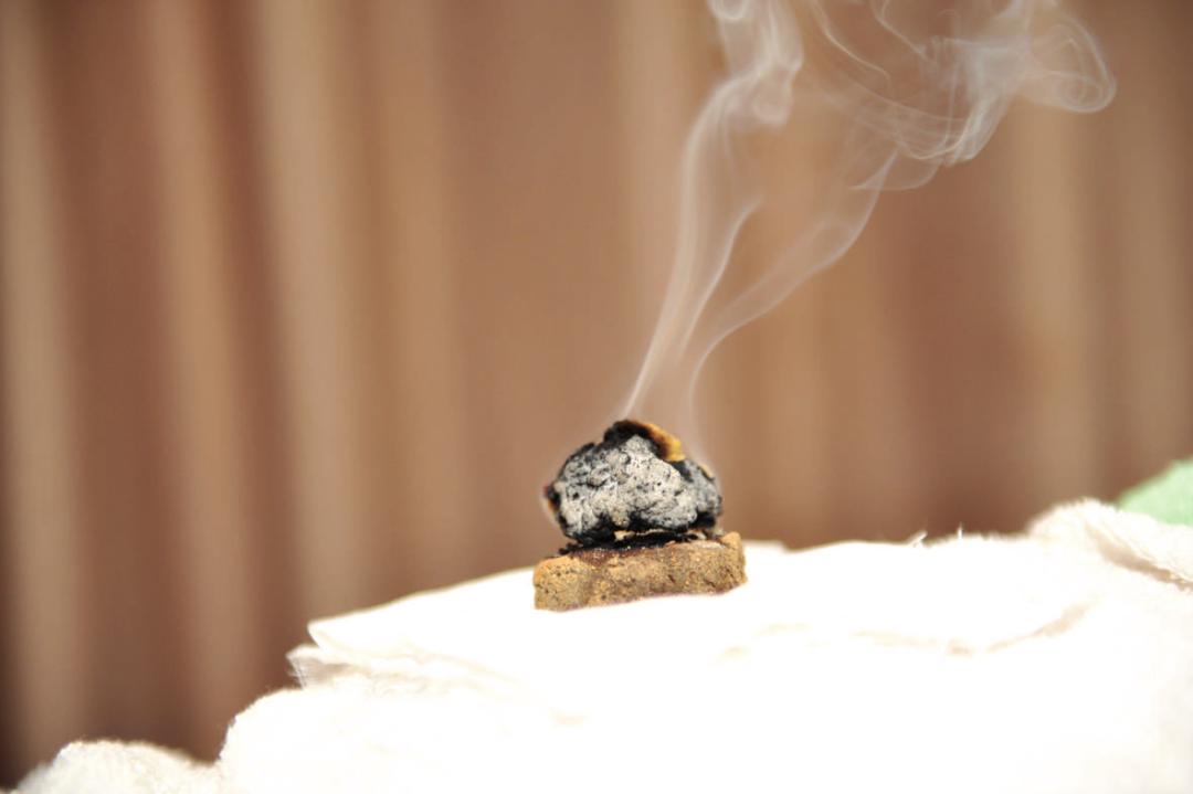 济南莱芜人民医院护理,济南脐疗