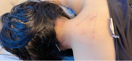 黄贵生：尺泽和太渊用法的区别，治疗感冒用针的基本盘，辩证