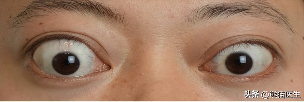 16年间增长20倍，这一部位病变累及全身