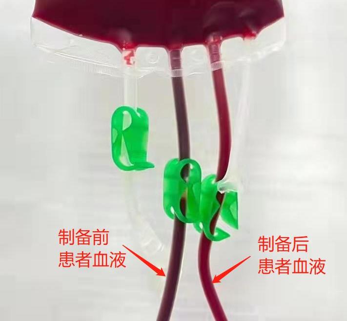 图解血管堵塞全过程，三氧疗法保持血管“年轻态”！