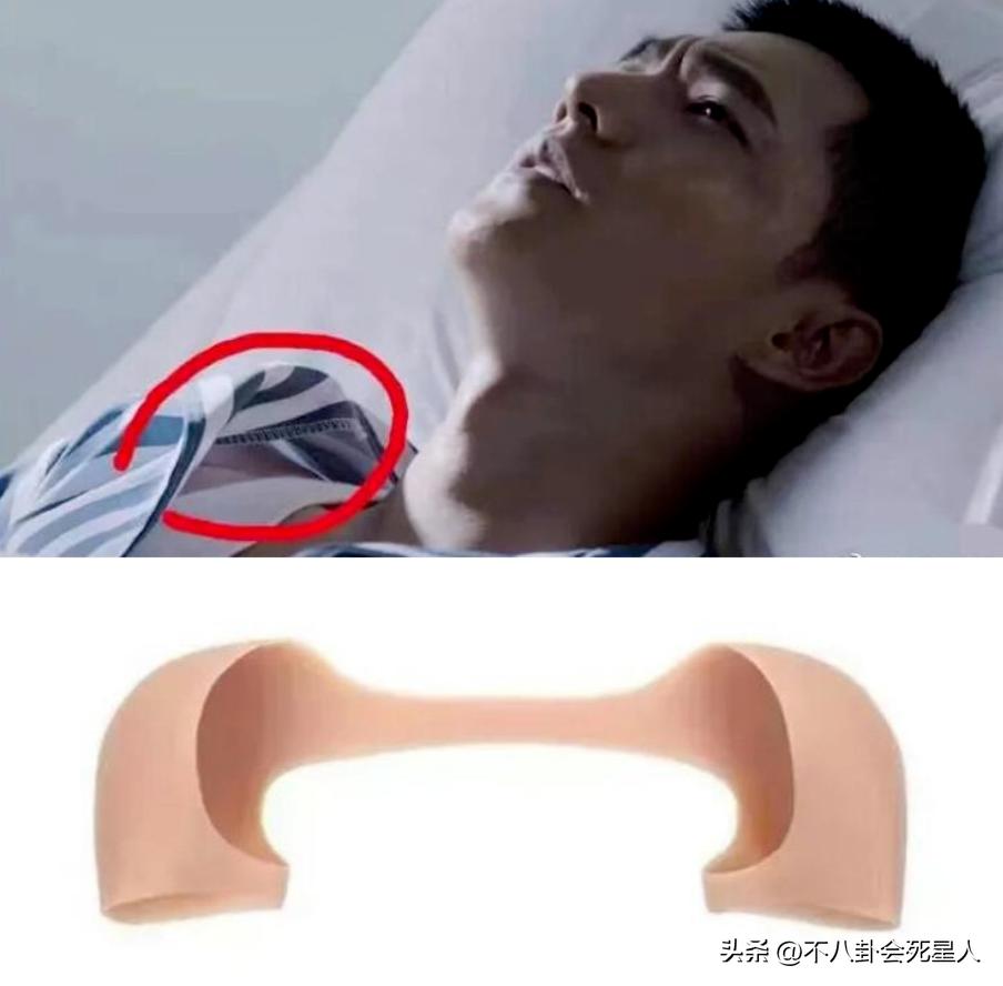 假双眼皮的明星,明星的假脸