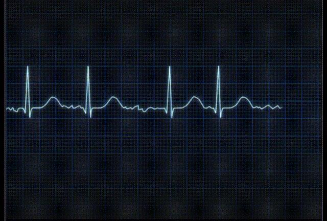 苹果手表开通了心电图能升级吗,苹果手表现在可以使用心电图功能