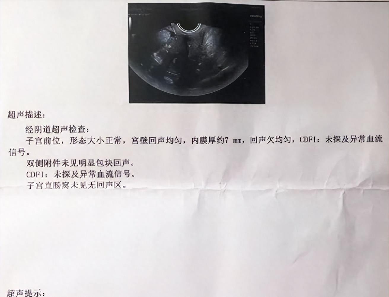 绝经两年后又见红，先生反复念叨“你受罪了”