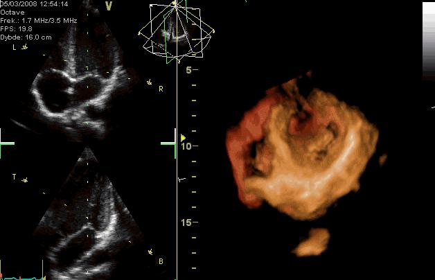 最厉害的杀人蜂,最有杀伤力的杀人蜂