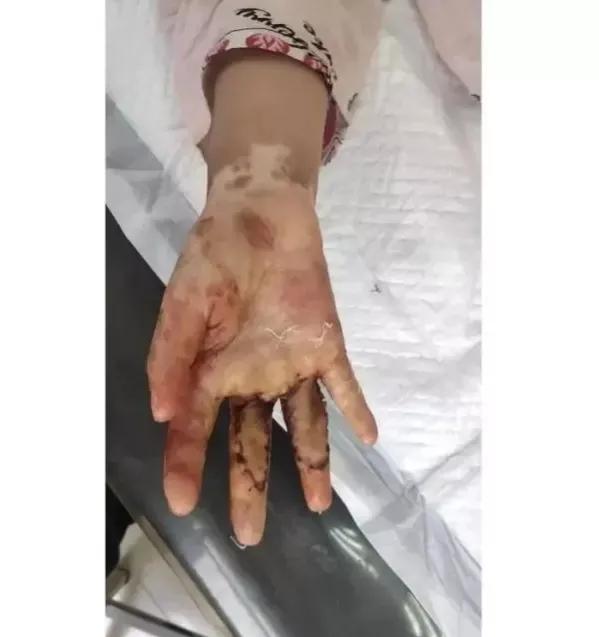 后妈把小孩按在地上暴打,后妈狠心用烟头弄孩子手上痛哭