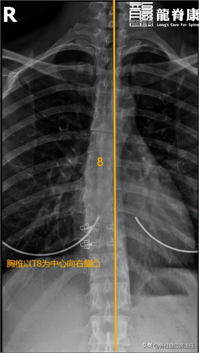 产后颈肩一直疼,产后肩和腰不舒服会恢复么