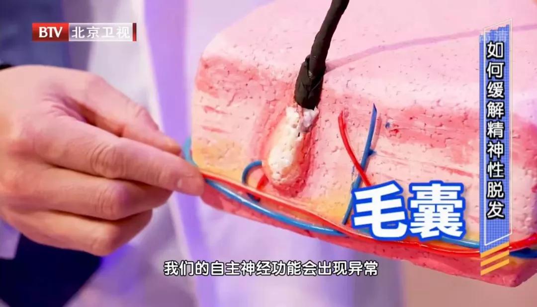 头皮屑多洗发水不应该有什么成分,头皮屑越洗越多真的只怪洗发水吗