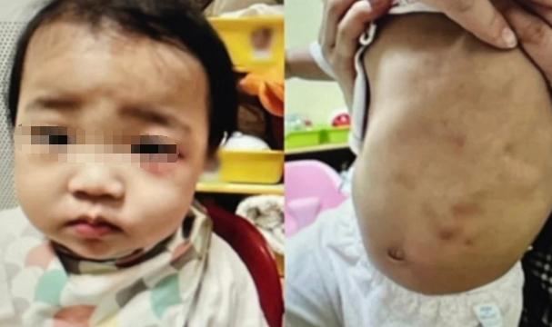 韩国小女孩郑仁被害真实事件,韩国郑仁虐童案真实事件