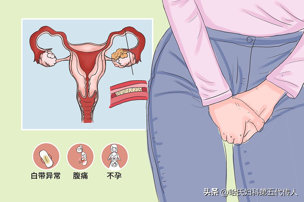 结婚三个月没怀孕怎么处理,结婚九年没有怀孕做过输卵管疏通