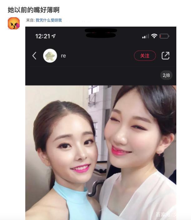 宋智雅用的精华水,宋智雅的嘴打了玻尿酸吗