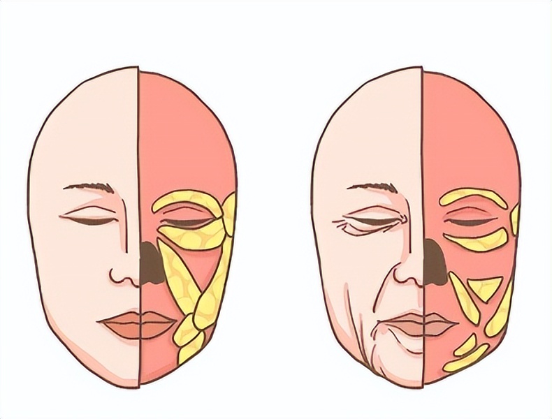 发腮和塌腮哪个更显老,发腮真的显老吗