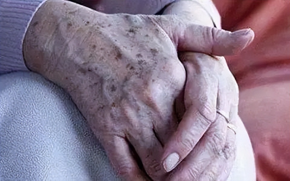 为什么有人没老年斑皮肤白,为什么40多岁就满脸老年斑