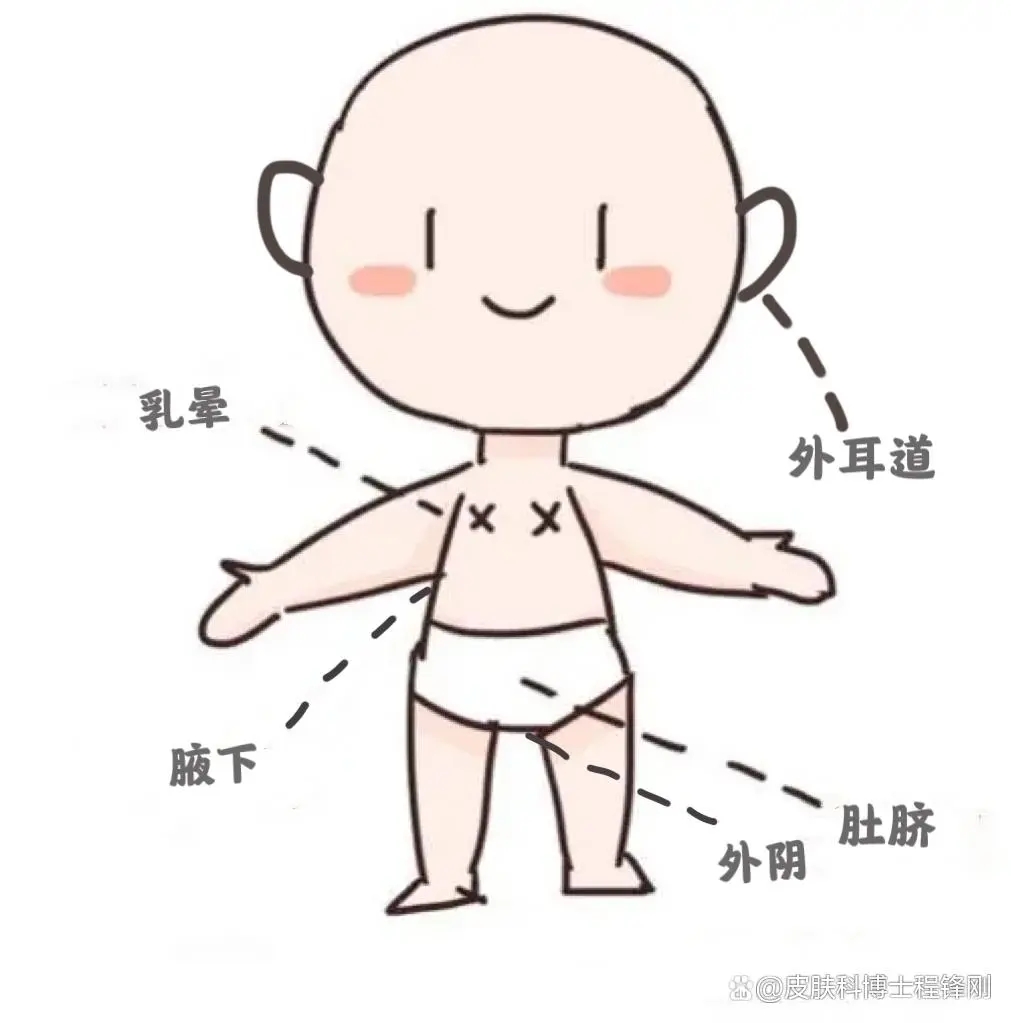 狐臭来源于身体哪个部位,私密处有狐臭味用什么药