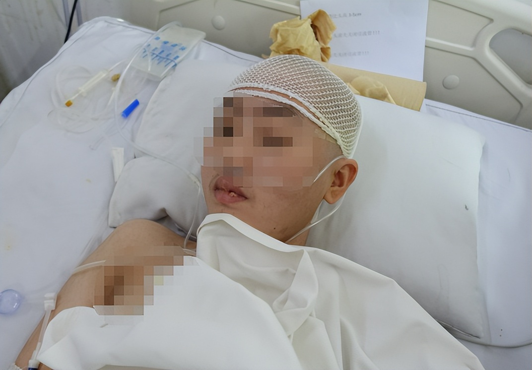 结核脑炎型脑积水怎么治,结核性脑膜炎2期很严重吗