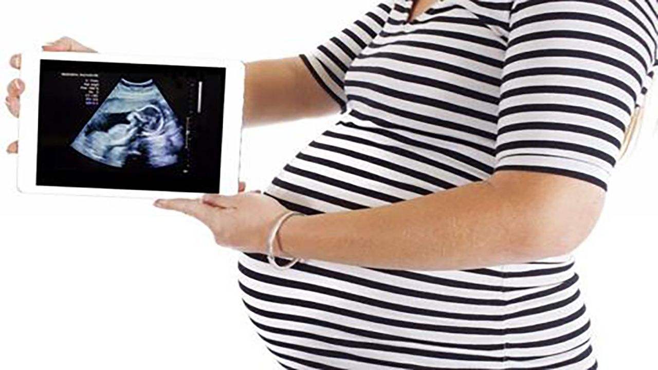 顺产VS剖宫产到底哪个好？终于有医生讲明白了，看完请多爱护女性