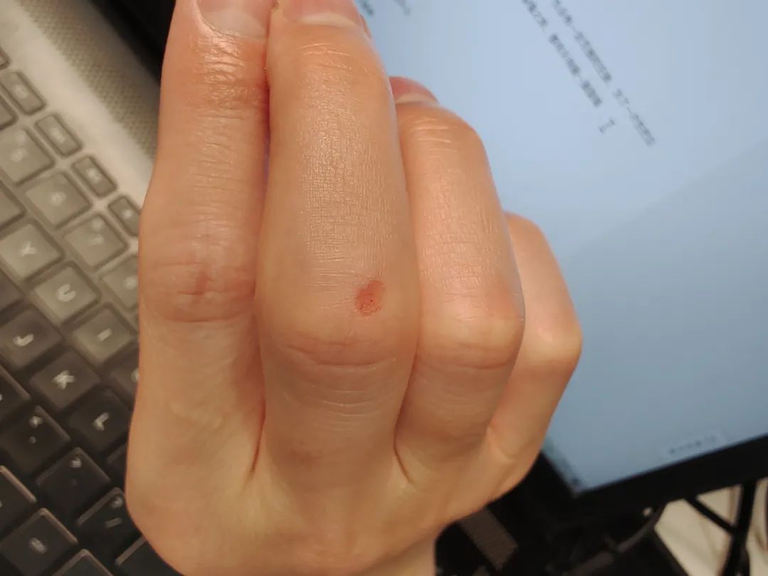 天花与墙边开裂如何修补,天花裂缝导致腻子层开裂怎么办