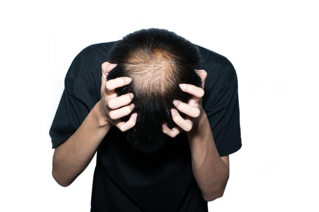 为什么有的人头发眉毛都稀疏呢,为什么有人头发天生是棕色