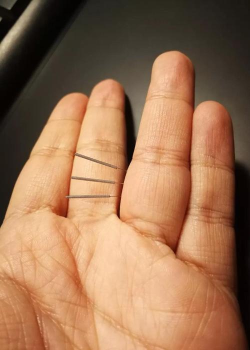 中医针灸治疗颈椎病原理,颈椎病针刀按摩针灸哪种方法好